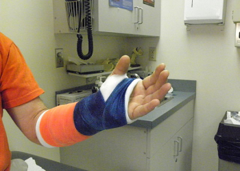 The Curious Case(s) of the Accident-Prone Irishman