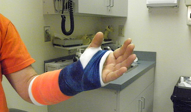 The Curious Case(s) of the Accident-Prone Irishman